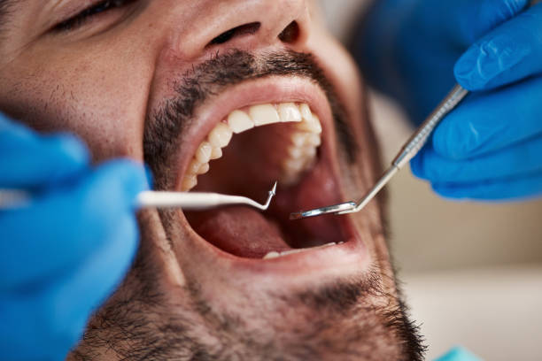 Best Emergency Treatment for Oral Infections in Banks Springs, LA